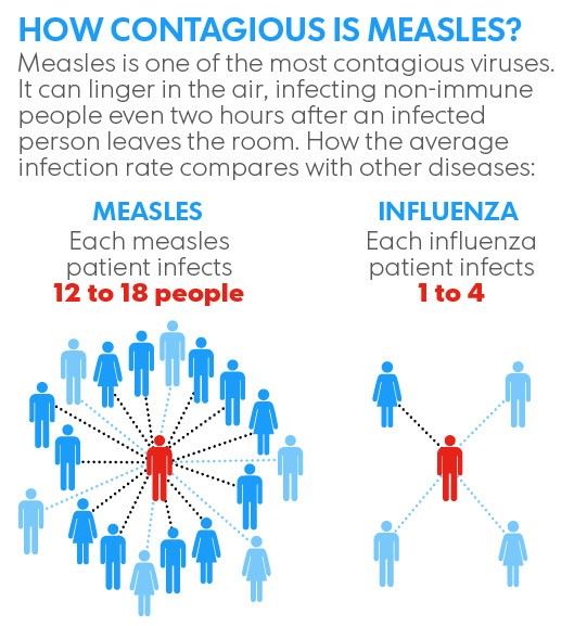 Measles